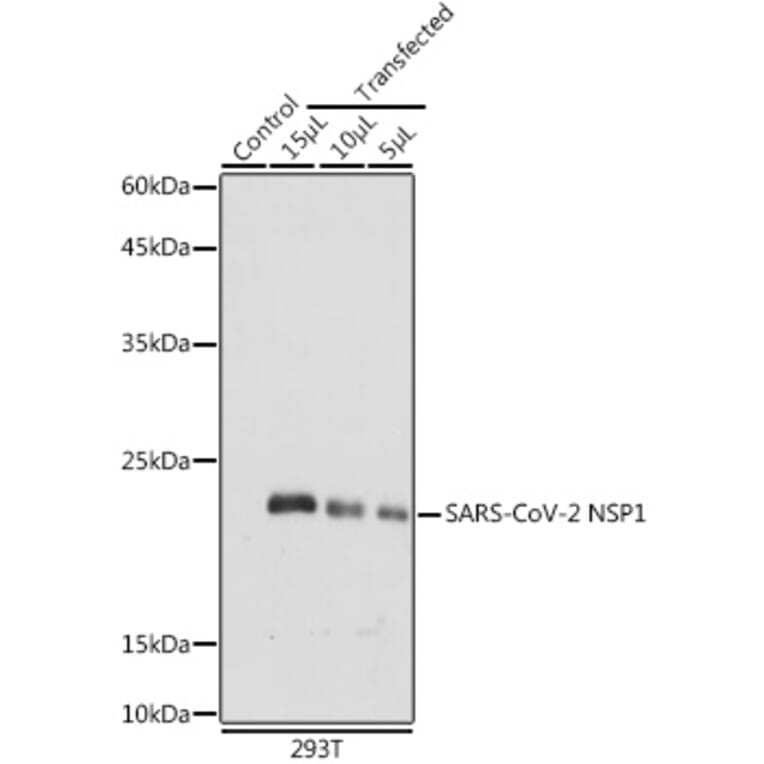 Western Blot - Anti-SARS-CoV-2 NSP1 Antibody (A307286) - Antibodies.com