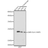 Western Blot - Anti-SARS-CoV-2 NSP1 Antibody (A307286) - Antibodies.com