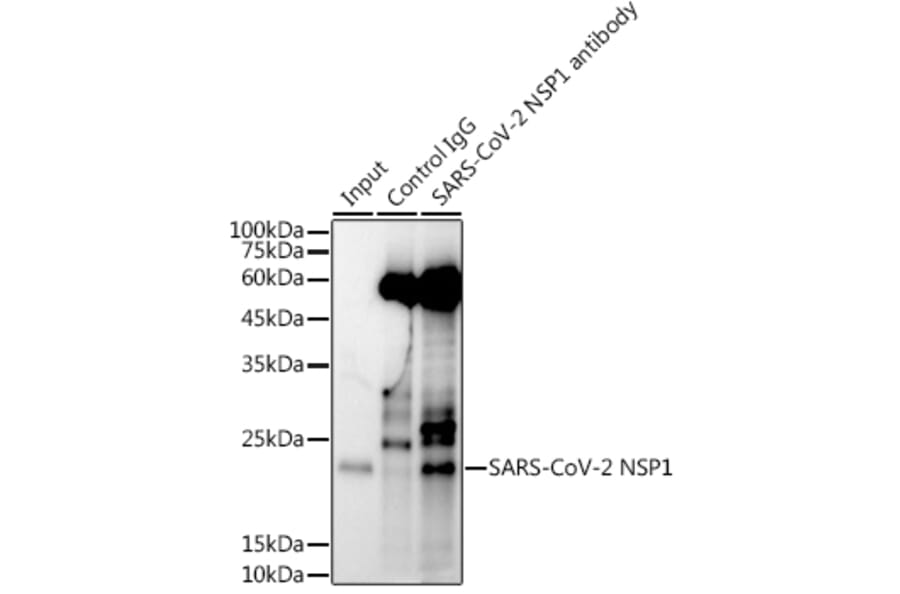 Western Blot - Anti-SARS-CoV-2 NSP1 Antibody (A307286) - Antibodies.com