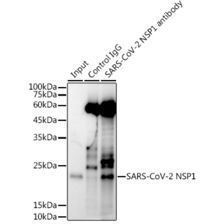 Western Blot - Anti-SARS-CoV-2 NSP1 Antibody (A307286) - Antibodies.com