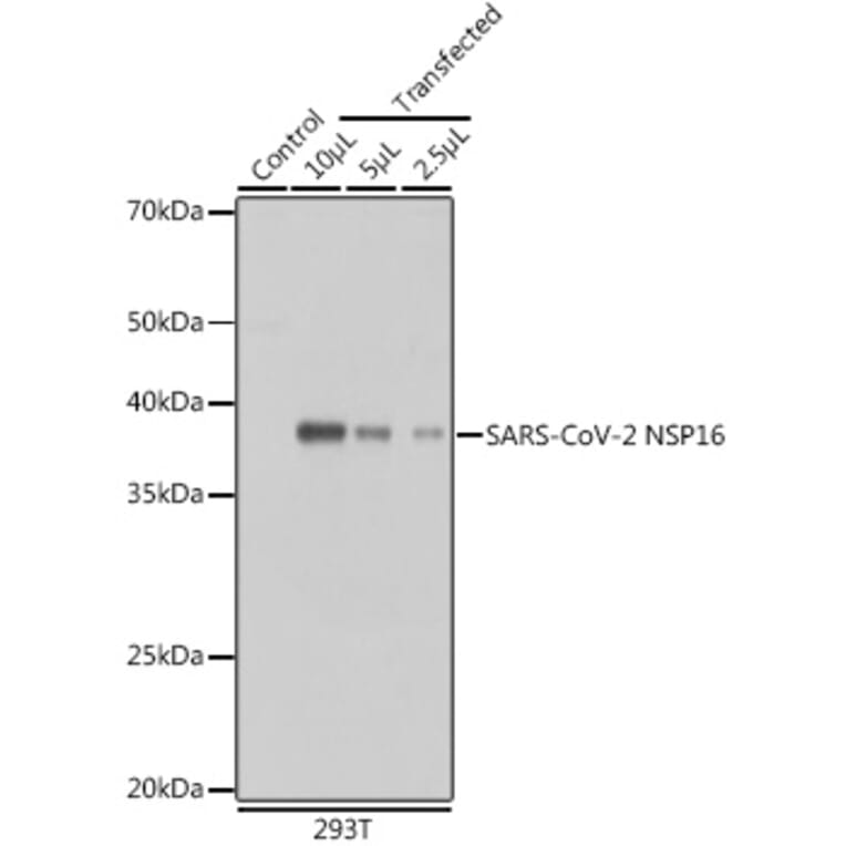 Western Blot - Anti-SARS-CoV2 NSP16 Antibody (A307290) - Antibodies.com