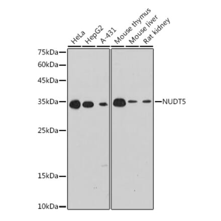 Western Blot - Anti-NUDT5 Antibody [ARC2525] (A307291) - Antibodies.com