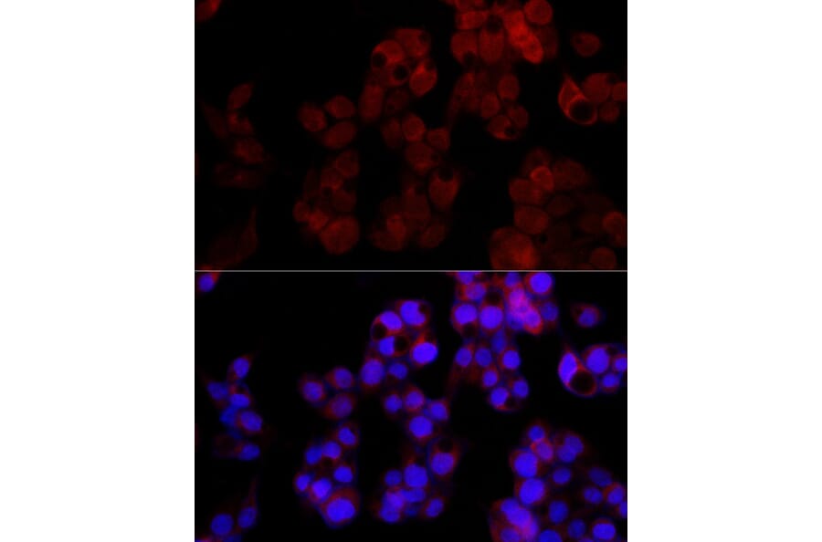 Immunofluorescence - Anti-NUDT5 Antibody [ARC2525] (A307291) - Antibodies.com