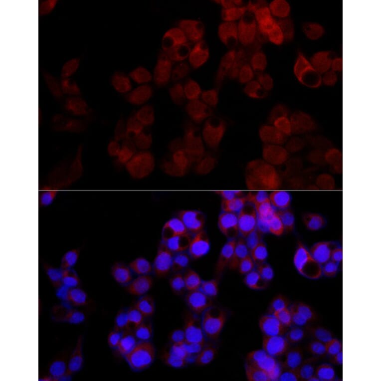 Immunofluorescence - Anti-NUDT5 Antibody [ARC2525] (A307291) - Antibodies.com