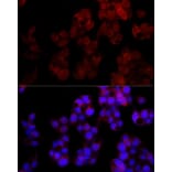 Immunofluorescence - Anti-NUDT5 Antibody [ARC2525] (A307291) - Antibodies.com