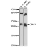 Western Blot - Anti-CEND1 Antibody (A307292) - Antibodies.com