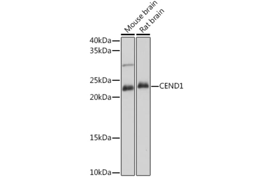 Western Blot - Anti-CEND1 Antibody (A307292) - Antibodies.com