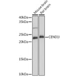 Western Blot - Anti-CEND1 Antibody (A307292) - Antibodies.com