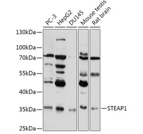 Western Blot - Anti-STEAP1 Antibody (A307293) - Antibodies.com