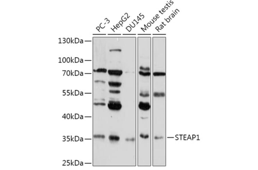Western Blot - Anti-STEAP1 Antibody (A307293) - Antibodies.com