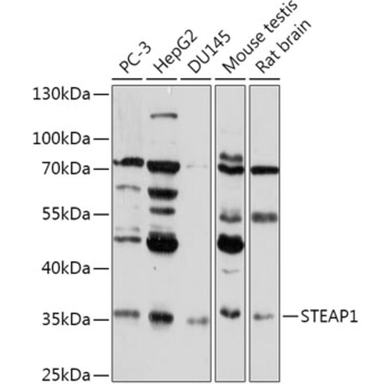 Western Blot - Anti-STEAP1 Antibody (A307293) - Antibodies.com