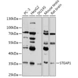 Western Blot - Anti-STEAP1 Antibody (A307293) - Antibodies.com