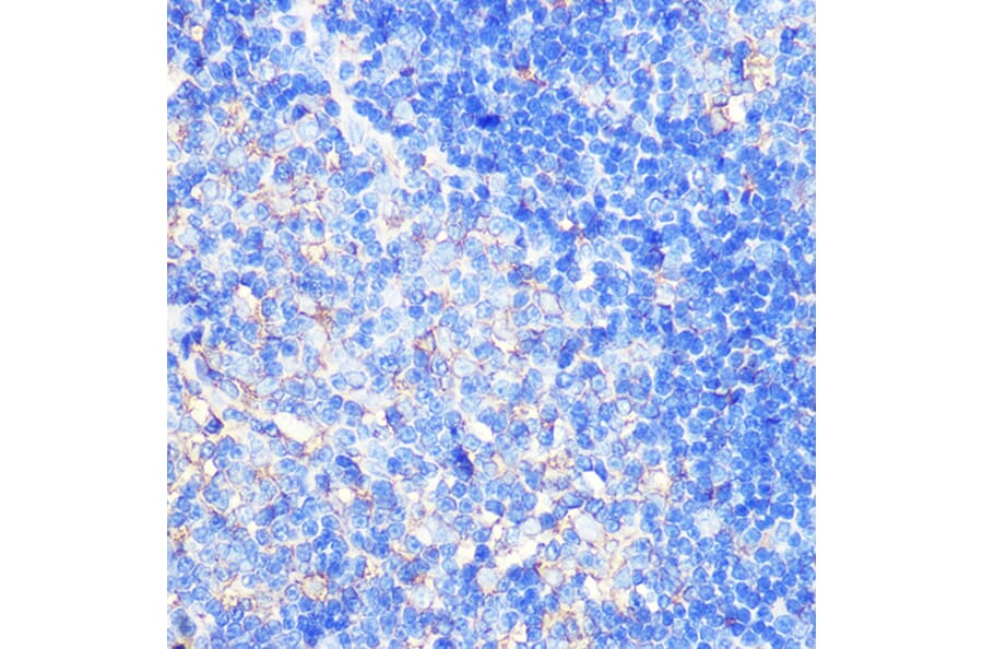 Immunohistochemistry - Anti-CCXCR1/XCR1 Antibody (A307294) - Antibodies.com