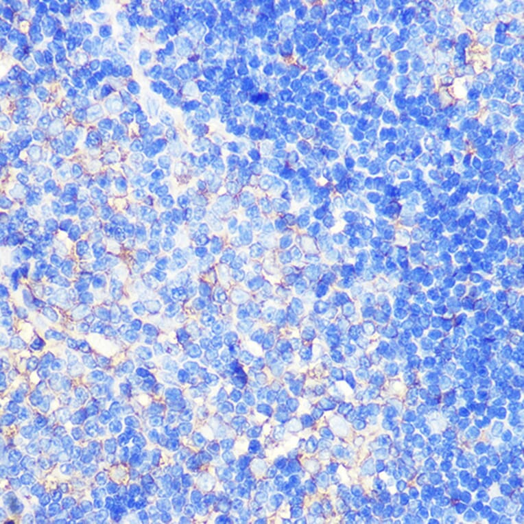 Immunohistochemistry - Anti-CCXCR1/XCR1 Antibody (A307294) - Antibodies.com