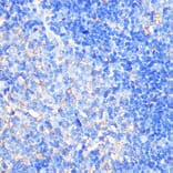 Immunohistochemistry - Anti-CCXCR1/XCR1 Antibody (A307294) - Antibodies.com