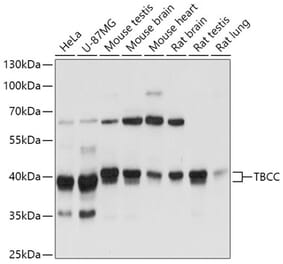 Western Blot - Anti-TBCC Antibody (A307295) - Antibodies.com