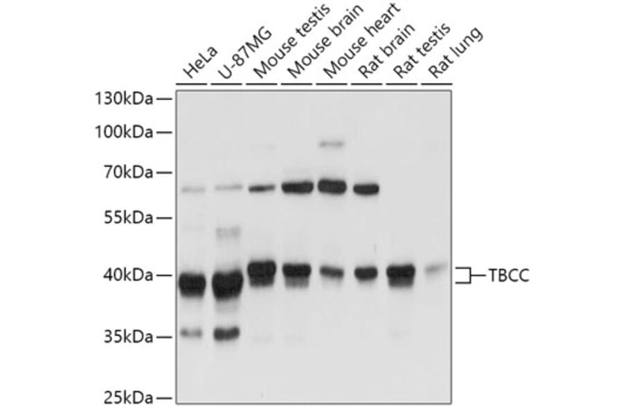 Western Blot - Anti-TBCC Antibody (A307295) - Antibodies.com