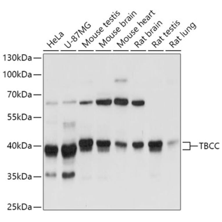 Western Blot - Anti-TBCC Antibody (A307295) - Antibodies.com