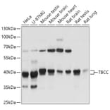 Western Blot - Anti-TBCC Antibody (A307295) - Antibodies.com