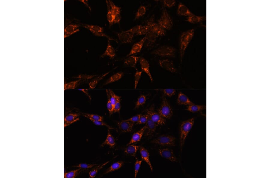 Immunofluorescence - Anti-TBCC Antibody (A307295) - Antibodies.com