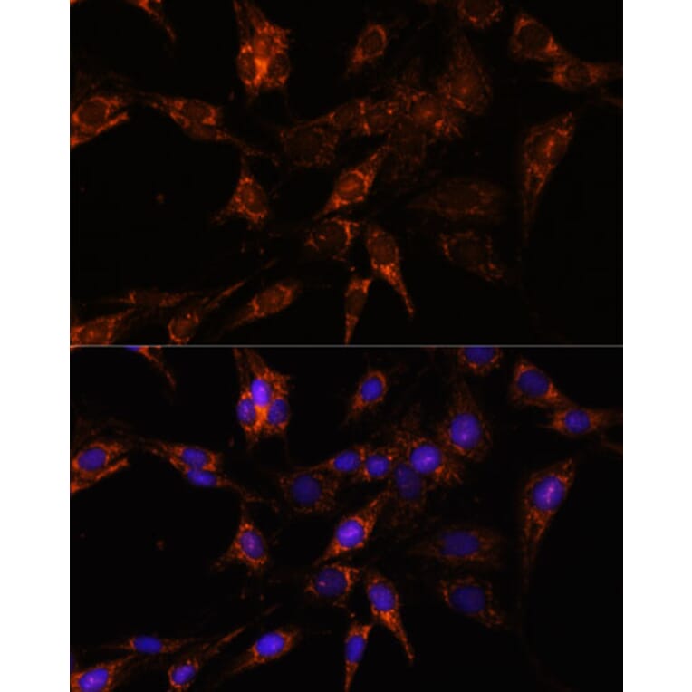 Immunofluorescence - Anti-TBCC Antibody (A307295) - Antibodies.com