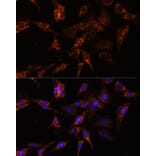 Immunofluorescence - Anti-TBCC Antibody (A307295) - Antibodies.com