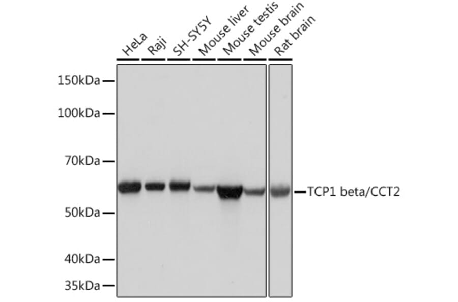 Western Blot - Anti-CCT2 Antibody [ARC1097] (A307296) - Antibodies.com