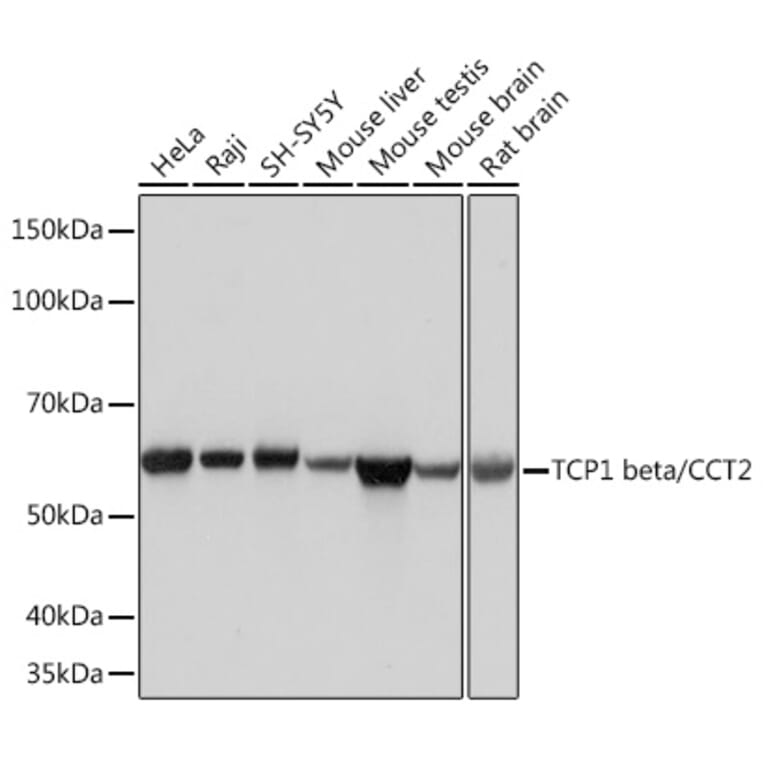 Western Blot - Anti-CCT2 Antibody [ARC1097] (A307296) - Antibodies.com