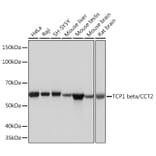 Western Blot - Anti-CCT2 Antibody [ARC1097] (A307296) - Antibodies.com