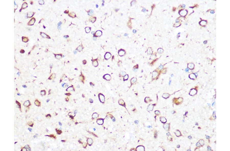 Immunohistochemistry - Anti-CCT2 Antibody [ARC1097] (A307296) - Antibodies.com