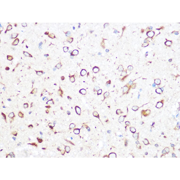 Immunohistochemistry - Anti-CCT2 Antibody [ARC1097] (A307296) - Antibodies.com