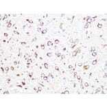 Immunohistochemistry - Anti-CCT2 Antibody [ARC1097] (A307296) - Antibodies.com