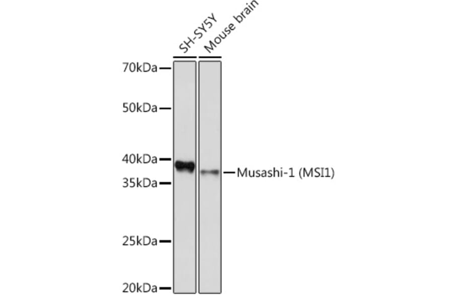 Western Blot - Anti-Musashi 1/Msi1 Antibody [ARC1796] (A307297) - Antibodies.com