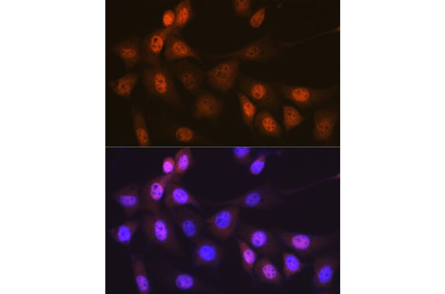 Immunofluorescence - Anti-Musashi 1/Msi1 Antibody [ARC1796] (A307297) - Antibodies.com