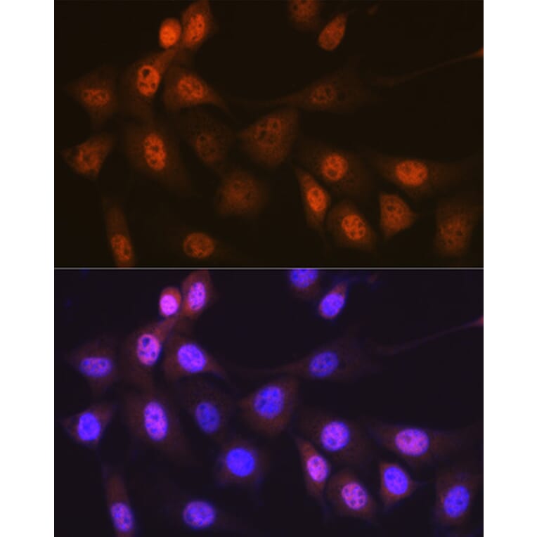 Immunofluorescence - Anti-Musashi 1/Msi1 Antibody [ARC1796] (A307297) - Antibodies.com
