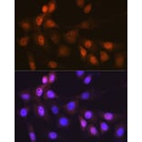 Immunofluorescence - Anti-Musashi 1/Msi1 Antibody [ARC1796] (A307297) - Antibodies.com