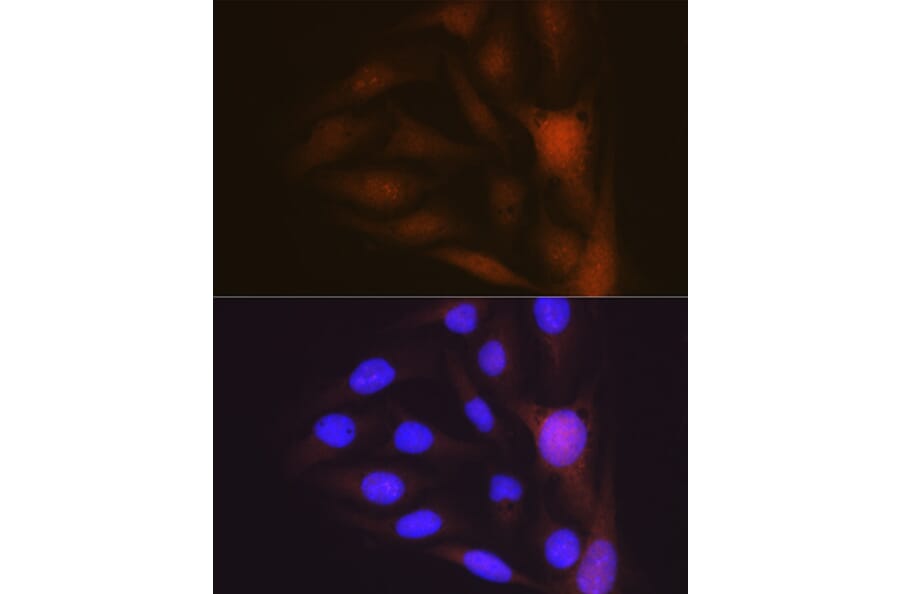Immunofluorescence - Anti-Musashi 1/Msi1 Antibody [ARC1796] (A307297) - Antibodies.com