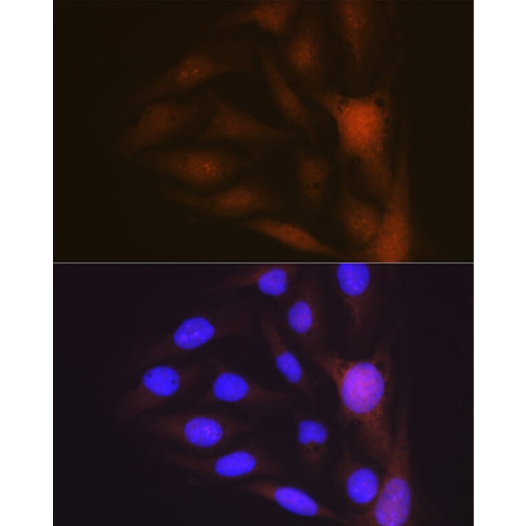 Immunofluorescence - Anti-Musashi 1/Msi1 Antibody [ARC1796] (A307297) - Antibodies.com