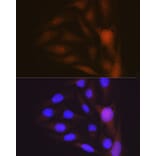 Immunofluorescence - Anti-Musashi 1/Msi1 Antibody [ARC1796] (A307297) - Antibodies.com