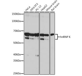 Western Blot - Anti-hnRNP K Antibody [ARC0512] (A307298) - Antibodies.com