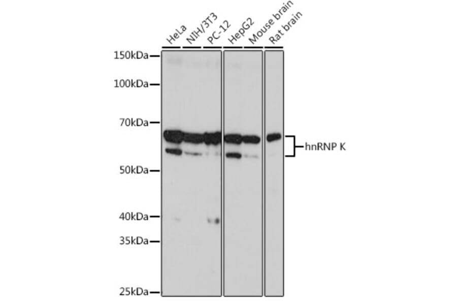 Western Blot - Anti-hnRNP K Antibody [ARC0512] (A307298) - Antibodies.com