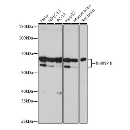 Western Blot - Anti-hnRNP K Antibody [ARC0512] (A307298) - Antibodies.com