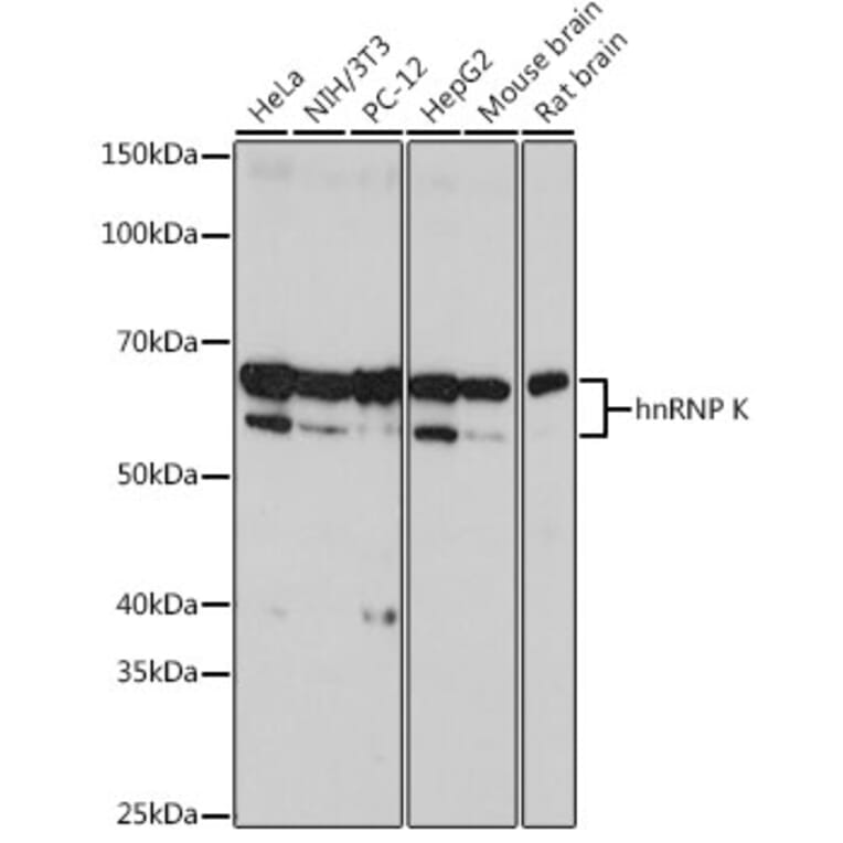 Western Blot - Anti-hnRNP K Antibody [ARC0512] (A307298) - Antibodies.com