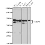 Western Blot - Anti-hnRNP K Antibody [ARC0512] (A307298) - Antibodies.com