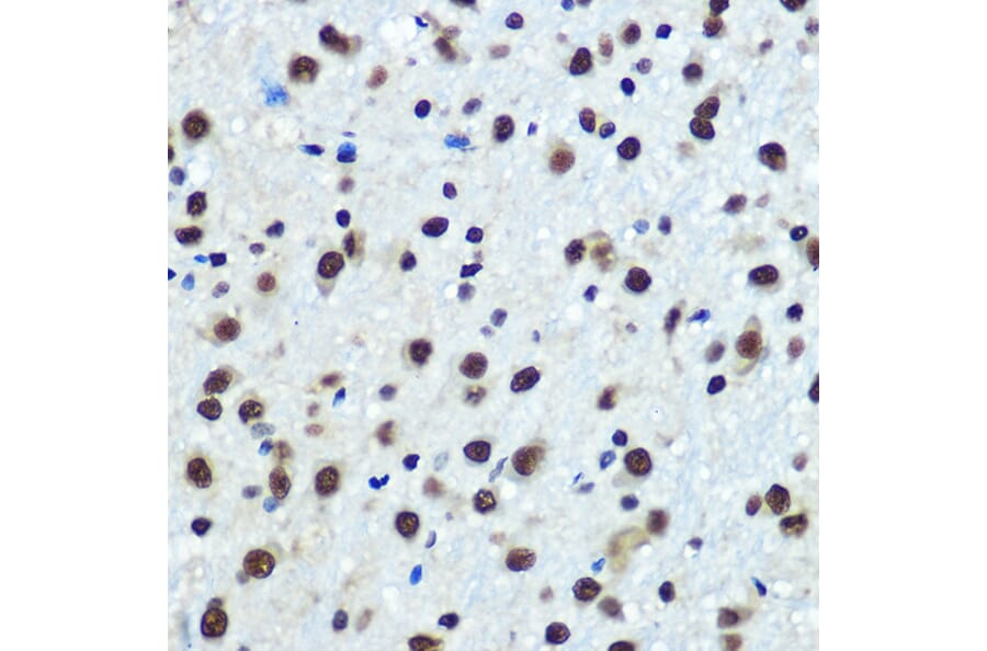 Immunohistochemistry - Anti-hnRNP K Antibody [ARC0512] (A307298) - Antibodies.com