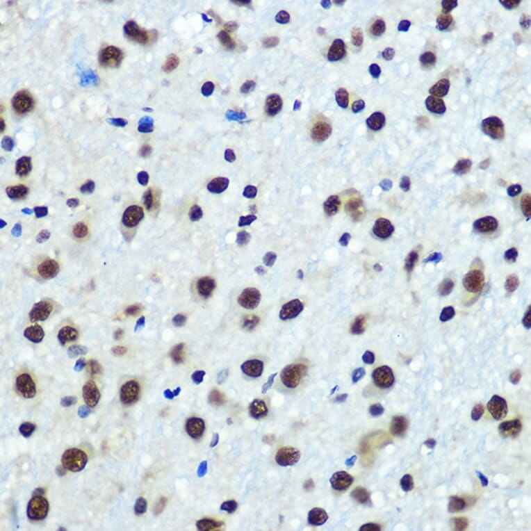 Immunohistochemistry - Anti-hnRNP K Antibody [ARC0512] (A307298) - Antibodies.com