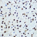 Immunohistochemistry - Anti-hnRNP K Antibody [ARC0512] (A307298) - Antibodies.com