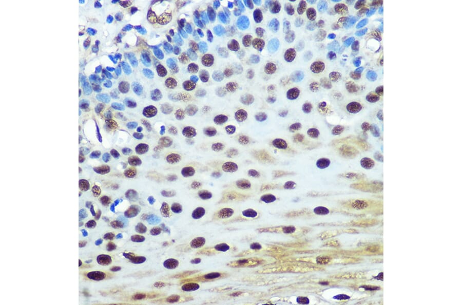 Immunohistochemistry - Anti-hnRNP K Antibody [ARC0512] (A307298) - Antibodies.com