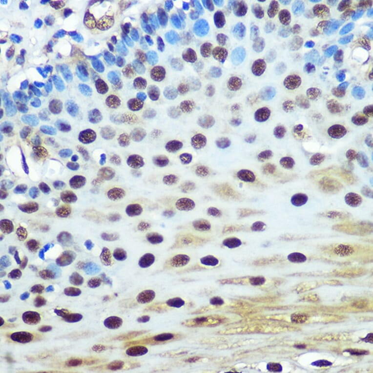 Immunohistochemistry - Anti-hnRNP K Antibody [ARC0512] (A307298) - Antibodies.com