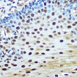 Immunohistochemistry - Anti-hnRNP K Antibody [ARC0512] (A307298) - Antibodies.com